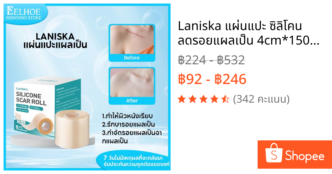 Laniska แผ่นแปะ ซิลิโคน ลดรอยแผลเป็น 4cm*150cm ซิลิโคนแปะแผลเป็น แปะแผลเป็น ลดรอยสิว แผลเป็นหลุม ไหมเย็บแผล แผลผ่าตัด