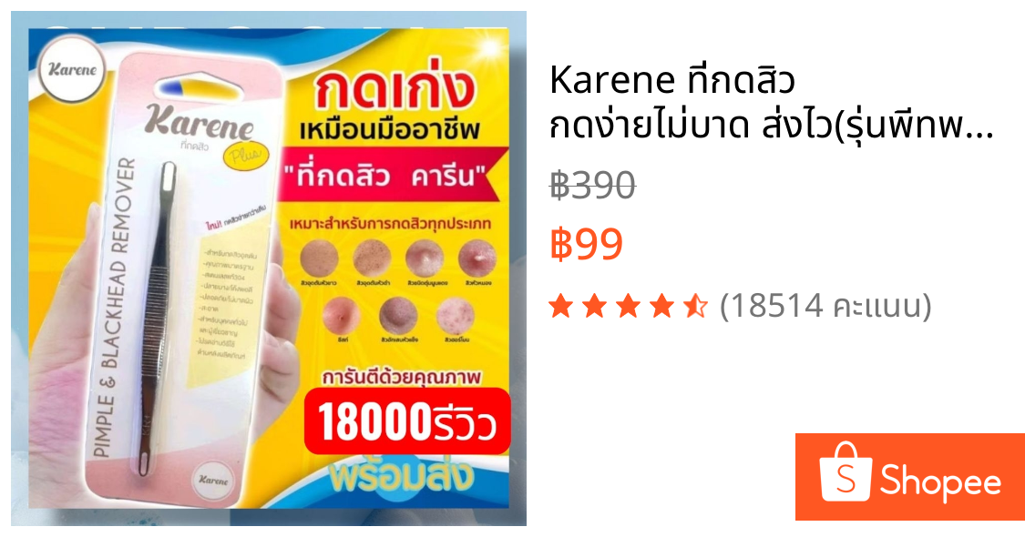 Karene ที่กดสิว กดง่ายไม่บาด ส่งไว(รุ่นพีทพามานา)แถมตัวช่วยเปิดสิว10ชิ้น คุ้มมาก ไม้กดสิว สเตนเลส304