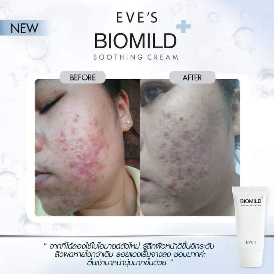 eves-biomild-soothing-cream-อีฟส์-ไบโอมายด์-ซูธธิ่ง-ครีม-ขนาด-30-g