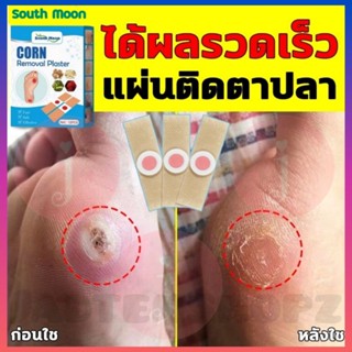 South Moon 12ชิ้น/กล่อง พลาสเตอร์แปะหูด ตาปลา มีSalicylicacid(กรดอ่อน) ช่วยให้หนังแข็งหลุดง่าย Corn Wart Remover Plaster