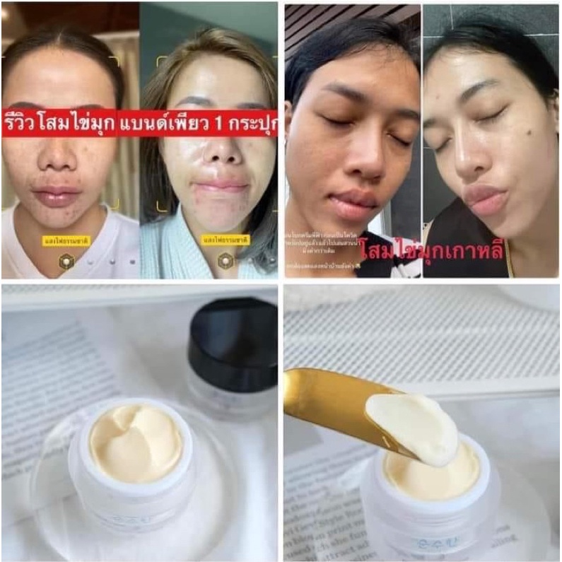 ครีมโสมไข่มุกเกาหลี-amp-pure-ครีมทารักแร้-pure-underarm-amp-เพียวออยล์-pure-oil-amp-เซรั่มนมผึ้ง-แบรนด์เพียว