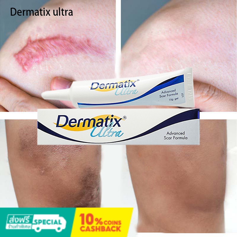 Dermatix ultra GEL Advanced SCAR GEL Reduction removal SCAR Treatment