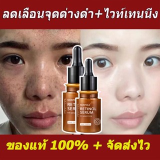 Dreamer Retinol เซรั่มบํารุงผิวหน้า ไวท์เทนนิ่ง ให้ความชุ่มชื้น ยกกระชับผิว ต่อต้านริ้วรอยแห่งวัย ลดเลือนริ้วรอย ขนาด 30 มล.