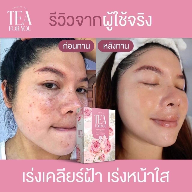 ชาชมพูลบฝ้าจางกระหายสิวริ้วรอยหน้าขาวใส1กล่อง20ซอง