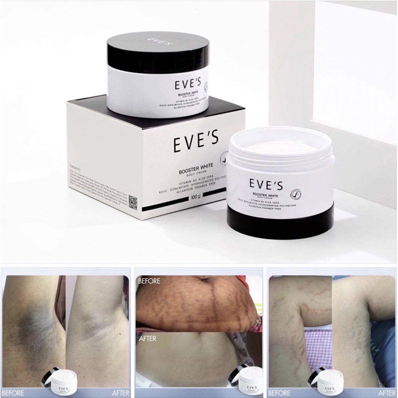 บูสเตอร์อีฟส์-ขนาด-100-g-eves-booster-white-body-cream-ครีมทารักแร้ดำ-ก้นดำ-ท้องลาย-แผลเป็น-หายได้แน่นอน