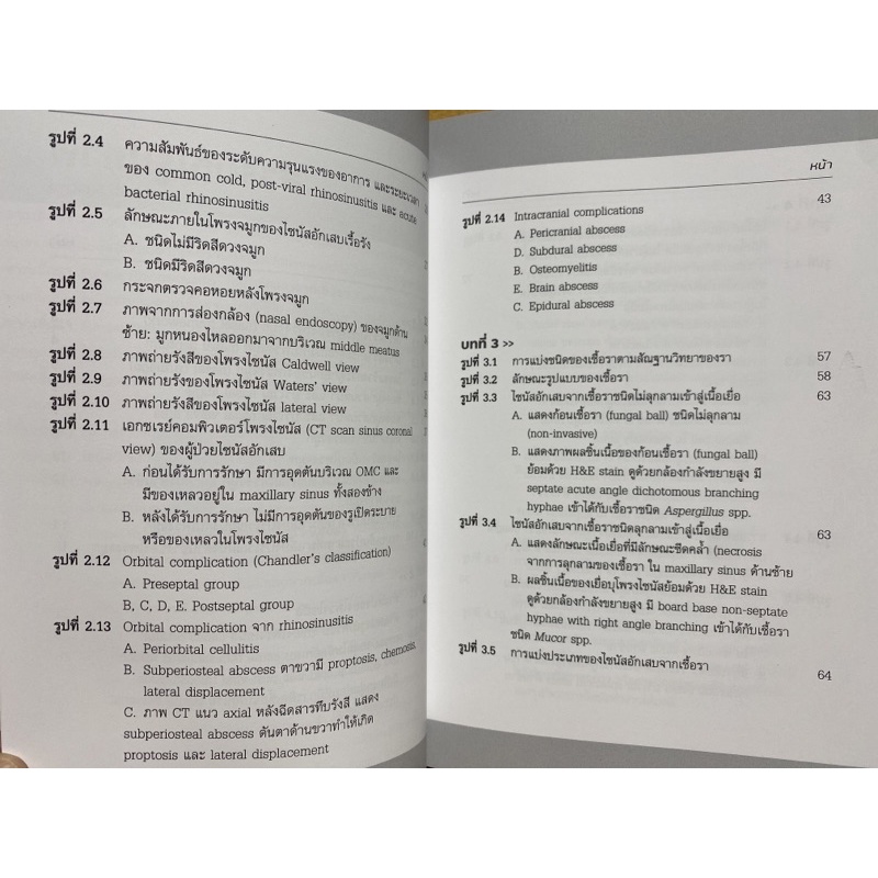 9786165828758-ไซนัสอักเสบจากเชื้อรา-fugal-rhinosinusitis