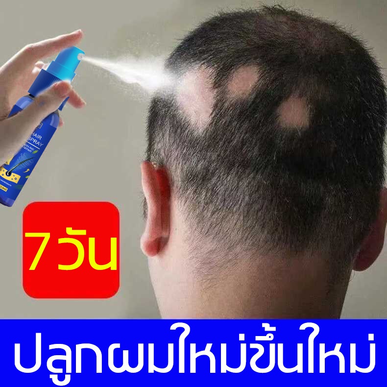 เห็นผลภายใน3วัน-eelhoe-ยาปลูกผมผู้ชาย-เร่งผมยาว-10-3วัน-30g-ปรับปรุงคุณภาพของเส้นผม-ป้องกันผมร่วง-เร่งผมขึ้นให