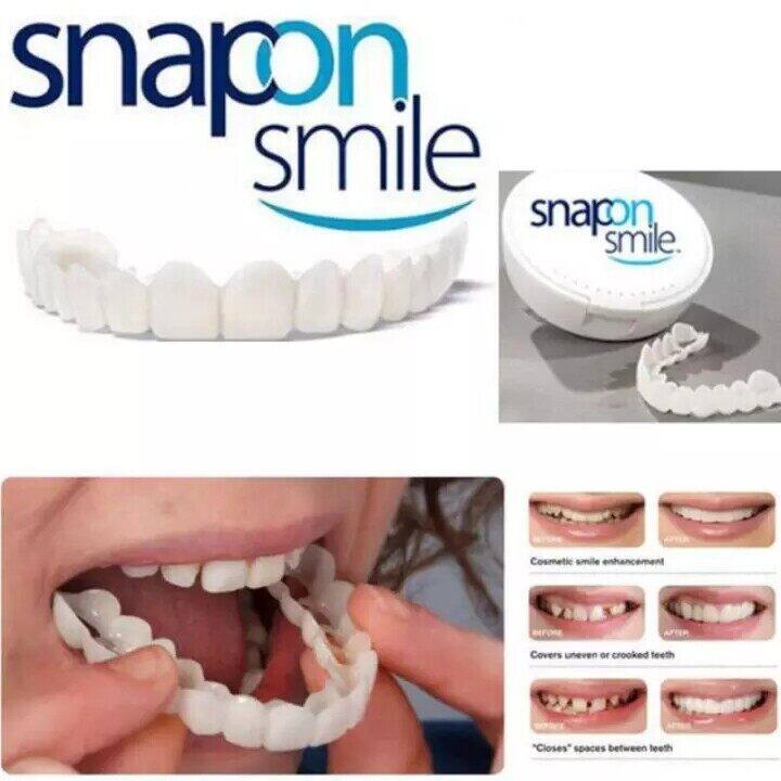 tooth-ฟันปลอม-ฟันปลอมถอดได้-ฟันปลอม-ฟันปลอมซี่หน้า-ฟันปลอม-ฟันปลอมสวม-เพิ่มความมั่นใจ