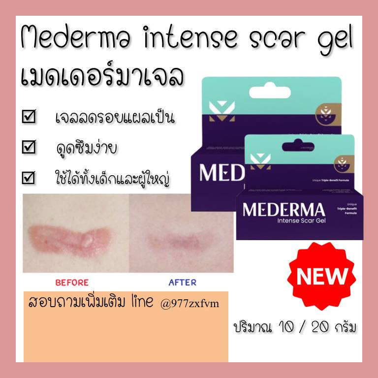 mederma-pm-intensive-overnight-cream-20g-intense-scar-gel-10gและ20g-บำรุงผิว-รักษารอยแผล-รักษารอยดำ