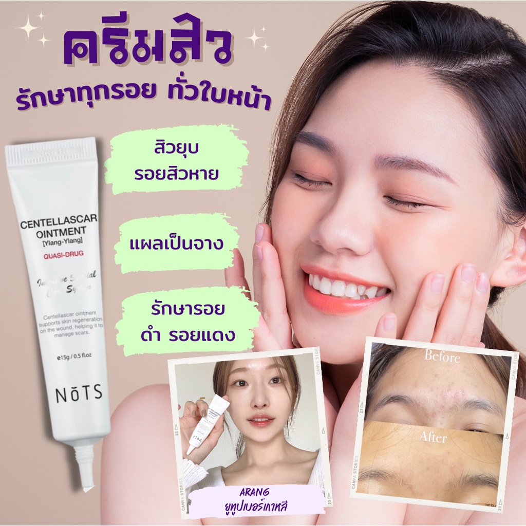 ส่งฟรี-แต้มสิวตัวดัง-ลดแผลและสิวที่กำลังอักเสบ-ทำให้สิวจางลง-ป้องกันการเกิดสิว-nots-centella-scar-ointment