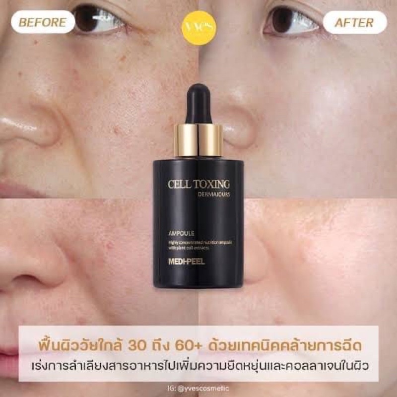 medi-peel-cell-toxing-dermajours-ampoule-100-ml-ราคาขวดละ-590บาท