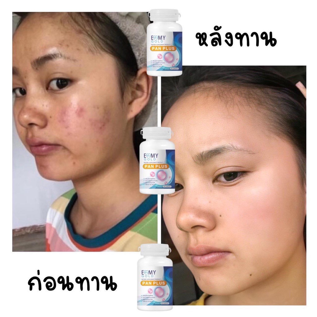 วิตามินผิวขาว-หมอแพนเค้ก-แพนพลัส-pan-plus-วิตามินสูตรตรงจากคลีนิคเรื่องผิว-เห็นผลจริงรีวิวแน่นมาก-1-กระปุกทานได้-3-เดือน