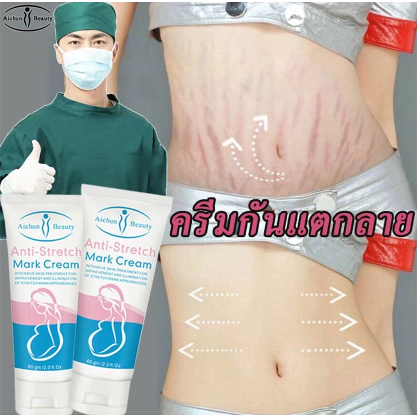 Aichun ครีมทาท้องลาย ผิวแตกลาย60G🔥แก้ท้องลาย ลดรอยแตกลาย ขาแตกลาย สะโพกลาย  ผิวลาย รอยแตกลาย ครีมลดรอยแตกลาย | Shopee Thailand