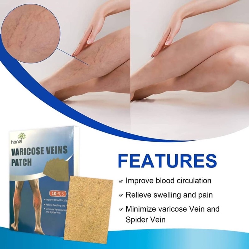 varicose-veins-patch-แผ่นแปะสมุนไพรแก้เส้นเลือดขอด