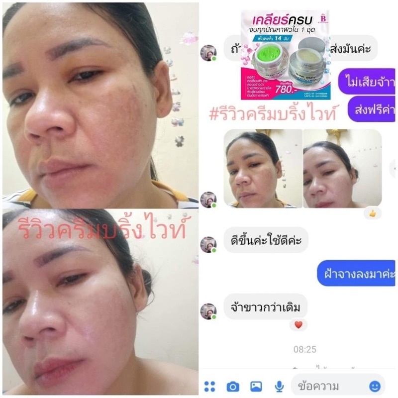 ครีมบริ๊งไวท์-สูตรเข้มข้น-ลดสิว-ฝ้ากระหน้าขาวใสส่งฟรี