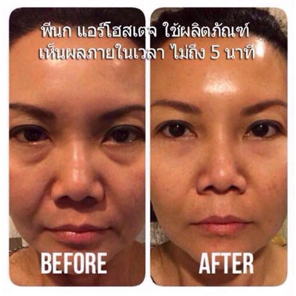 instantly-ageless-ครีมลดถุงใต้ตา-แบ่งขาย-1หลอด-0-6ml-jeunjesse-instantly-ageless-ครีมลดริ้วรอย-และถุงใต้ตา