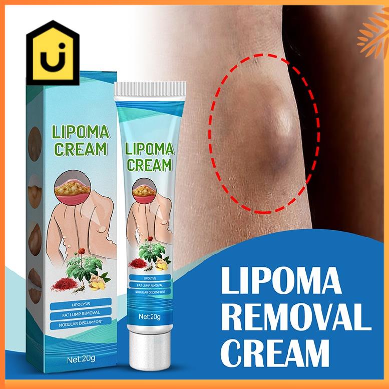 bioaoua-lipoma-removal-cream-ครีมสลายไขมันครีมไขมันครีมลดการก่อตัวไขมันครีมกำจัดไขมันก้อนครีมสลายไขมันก้อนครีมลดไขมั