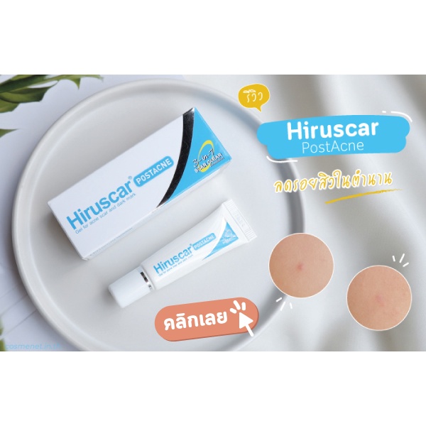 hiruscar-postacne-ลดรอยแผลเป็นจากสิว