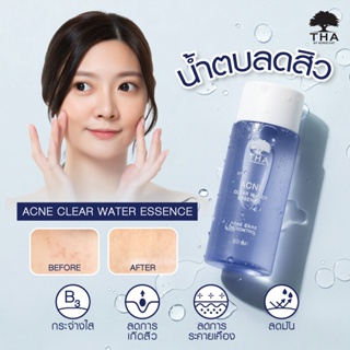 แอคเน่เคลียร์วอเตอร์เอสเซนต์ 50ml. THA BY NONGCHAT Acne Clear Water Essence น้ำตบลดมัน กระชับรูขุมขน 50ml.