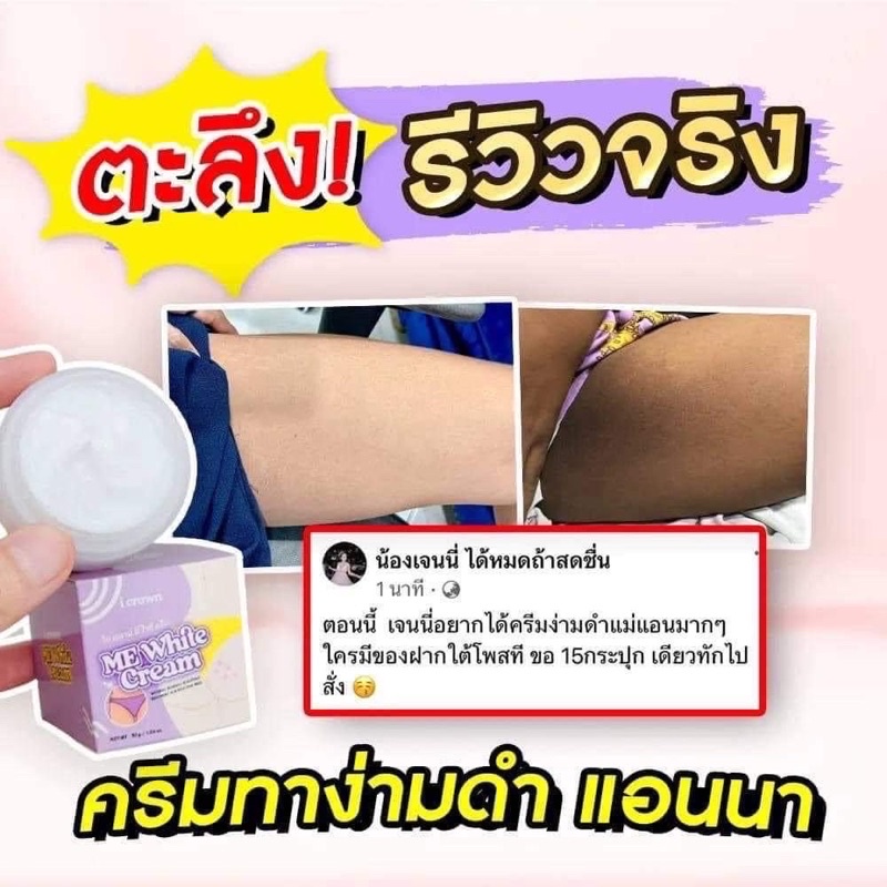 ครีมทาง่ามขาแอนนา-ของแท้-100-มีบัตรตัวแทนจำหน่าย