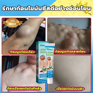 แท้ [South Moon] ออกแบบ36ชนิดของไขมันใต้ผิวหนังกำจัดมวลก้อนไปยังถุงน้ำ Lymph Care Ointment สมุนไพรกำจัด ก้อนเนื้อใต้ผิวห