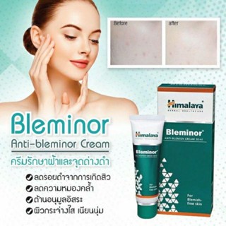 Himalaya Bleminor ลดเลือนรอยดำ ฝ้า