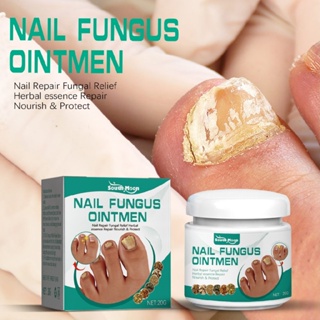 20g Nail Fungus Treatment Natural Antifungal Toenail Repair Cream