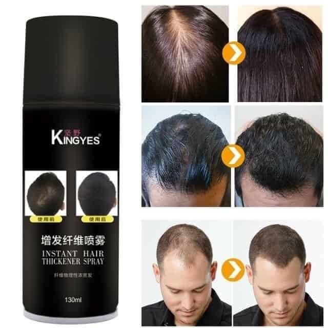 kingyes-hair-spray-สเปรย์ผมไฟเบอร์-ปิดผมบาง-แก้ปัญหาหัวล้าน-ผงไฟเบอร์สีดำ-ปิดผมบาง-หัวล้าน-ผมบาง