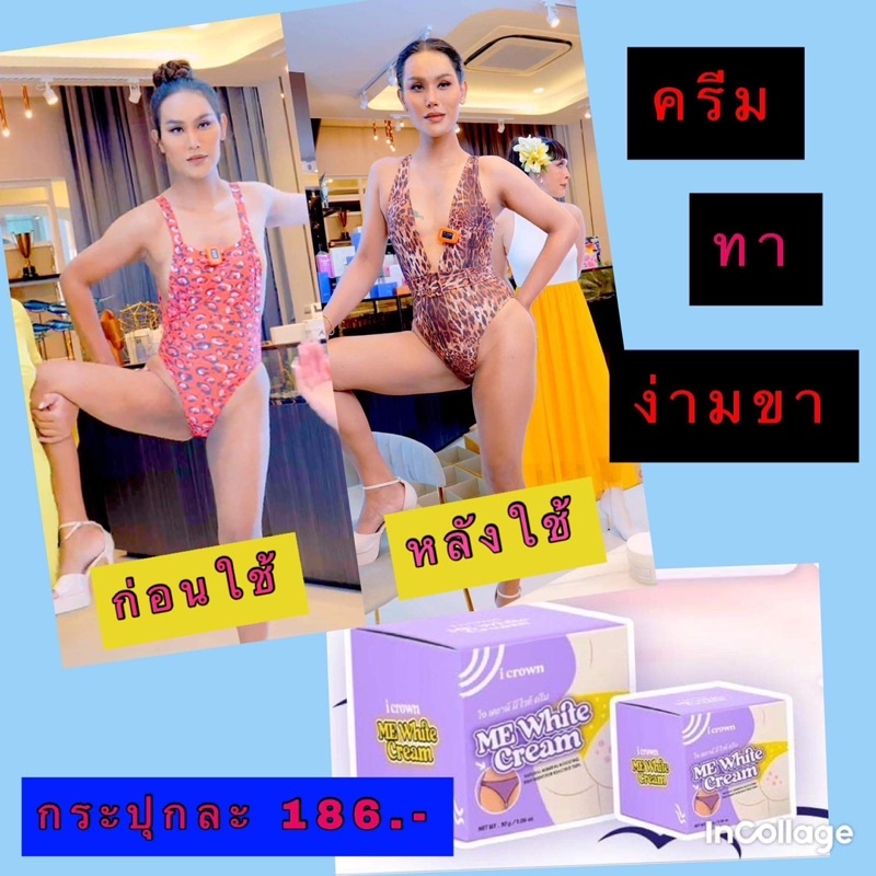 ครีมทาง่ามขาแอนนา-ของแท้-100-มีบัตรตัวแทนจำหน่าย