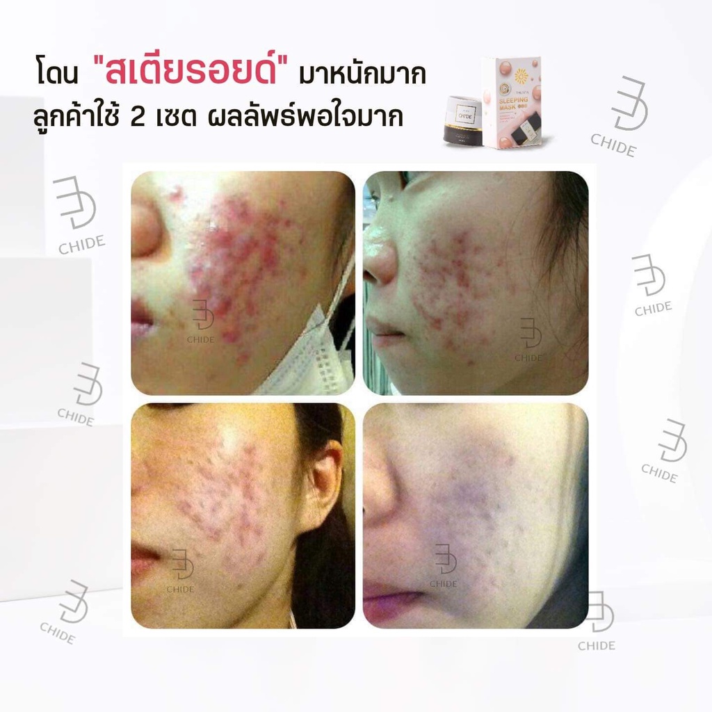 สบู่หน้าเงา-สบู่ใช้ดี-ก้อนใหญ่120กรัม