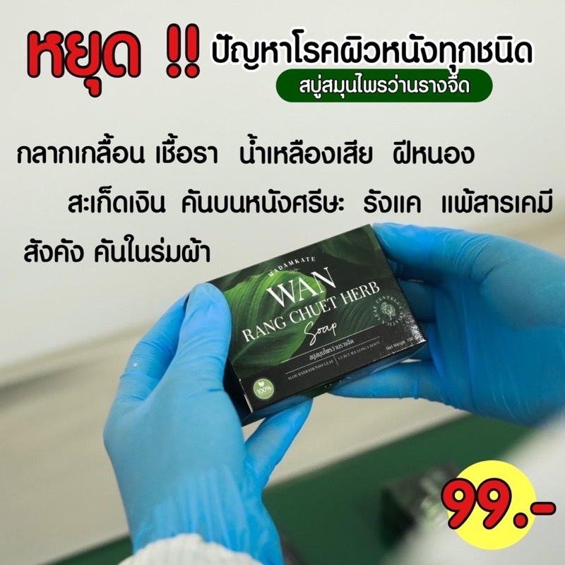 ส่งฟรีของแท้-สบู่ลดรอยแตกลาย-กลากเกลื้อน-เชื้อรา-โรคผิวหนัง-แก้ผื่นคัน-แพ้ผื่นแมลง-ขนาด-100-กรัม