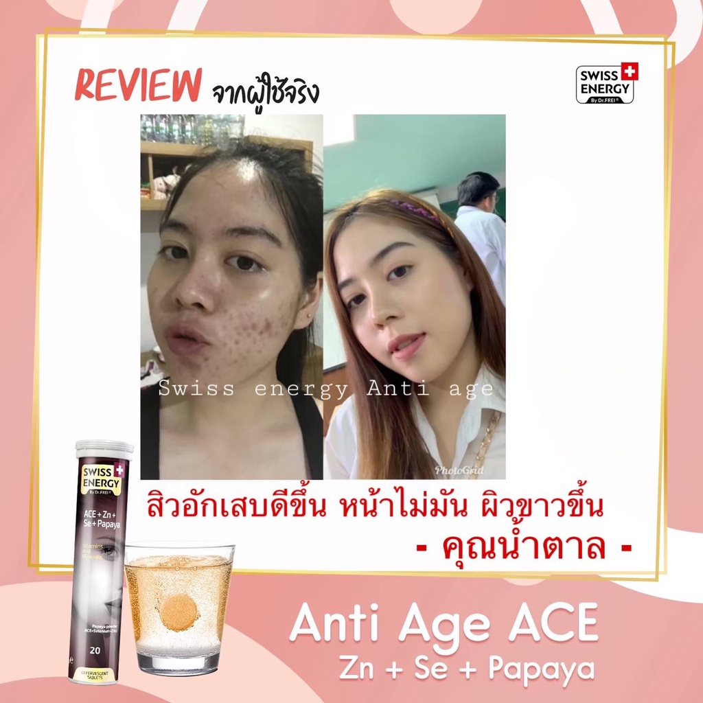 ส่งฟรี-4-แถม-1-หลอด-ฟรีของแถม-swiss-energy-ace-anti-age-วิตามิน-a-c-e