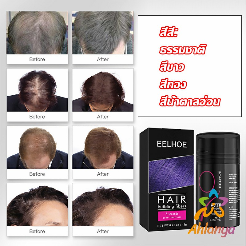 ahlanya-ผงไฟเบอร์ผม-ผมเพิ่มขึ้น-ให้ดูผมหนา-ปิดหัวเหม่ง-hair-building-fibers