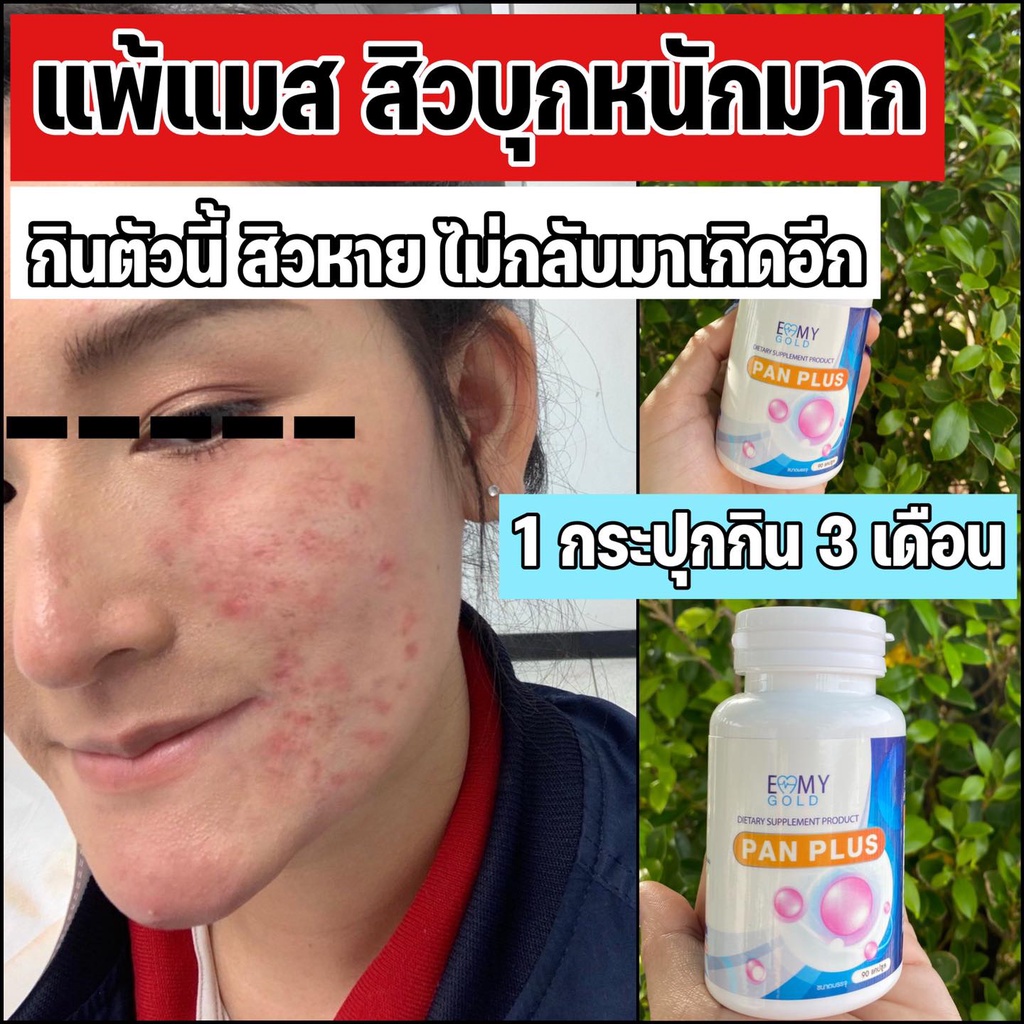 วิตามินผิวขาว-หมอแพนเค้ก-แพนพลัส-pan-plus-วิตามินสูตรตรงจากคลีนิคเรื่องผิว-เห็นผลจริงรีวิวแน่นมาก-1-กระปุกทานได้-3-เดือน