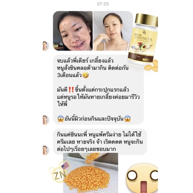 ซิลคลอต้า-zinclota-ของแท้จากบริษัท-น้องมีอย-น้องปลอดภัย-กินดี-กินเอง-บอกต่อ