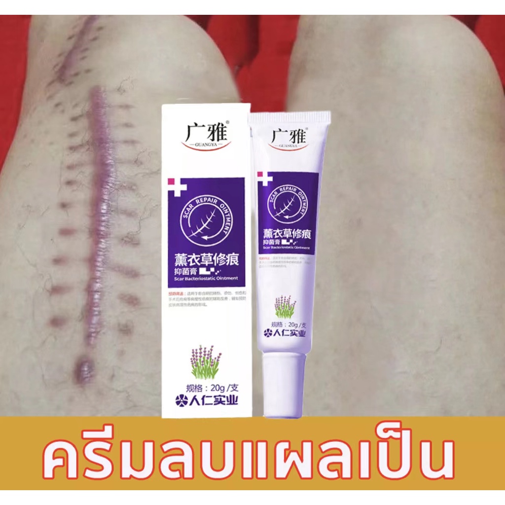 ผลลัพธ์ที่รวดเร็ว-ครีมลบแผลเป็น-20g-ครีมลดรอยแผลเป็นลดแผลไฟไหม้แผลน้ำร้อนลวกแผลผ่าตัดเป็นต้นแผลเป็นหลายประเภทยาลบลอยแผล