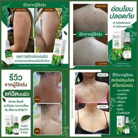 ส่งฟรี-สเปรย์แก้คัน-ของเเท้-สเปรย์สมุนไพร-100-รักษา-กลากเกลื้อน-สังคัง-สะเก็ดเงิน-เชื้อราต่างๆ-เชื้อราบนหนังศรีษะ