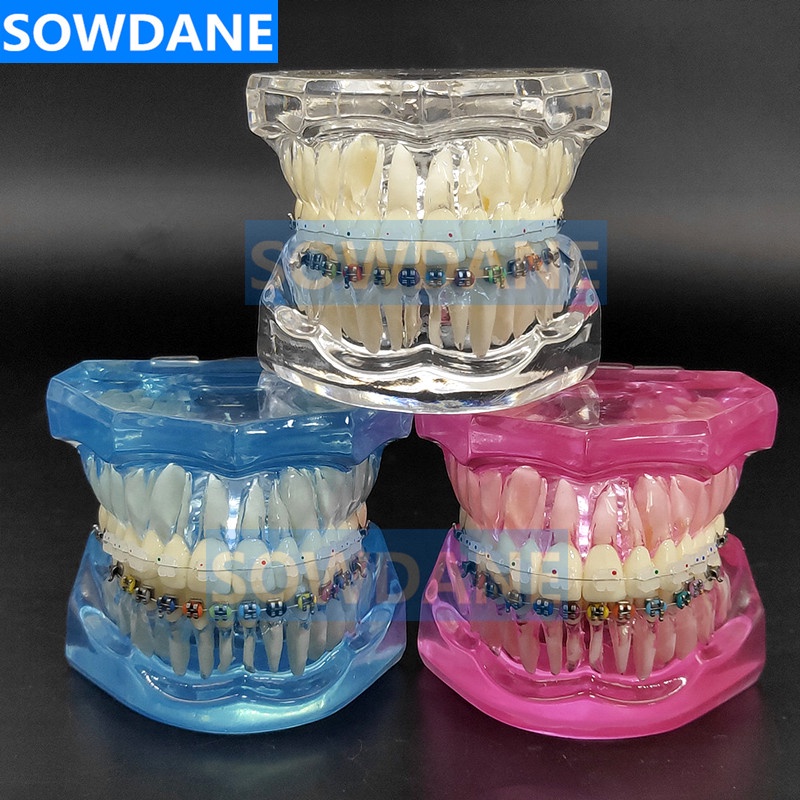 Dental Orthodontic Model Patient Communication 2 kinds Brackets with