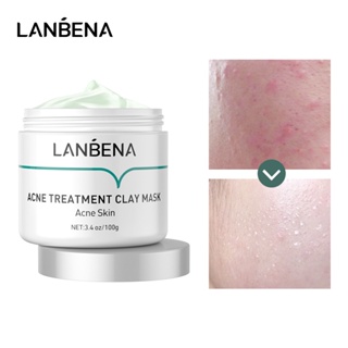 LANBENA Acne Treatment Cleansing Mask Purifying Clay Stick Oil Control Skin Care Anti-Acne mask Remove Blackhead Mud Mas