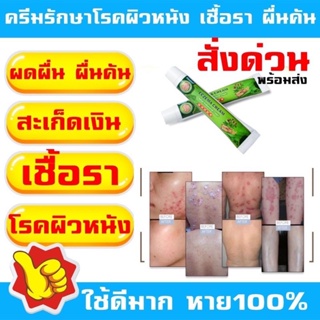 ครีมทากลากเกลื้อน SUMIFUN ECZEMA ของแท้ 100% (จัดส่งในไทย) ครีมสมุนไพรจีน ครีมเดิมสำหรับโรคผิวหนัง เชื้อรากลาก