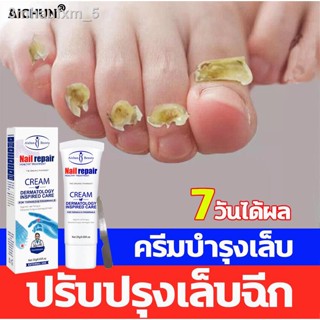 Aichun เซรั่มบำรุงเล็บ ครีมบำรุงเล็บ เล็บขบ ที่ตัดเล็บขบ ยาทาเล็บขบ รักษาเล็บ เชื้อราที่เล็บ ยาบำรุงเล็บ ยาเล็บขบ ปรับปร