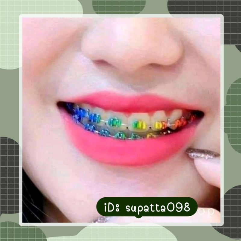 เซตยางเปลี่ยนสีรุ้งใช้เปลี่ยนสียางฟันหรือรีเทนเนอร์ | Shopee Thailand