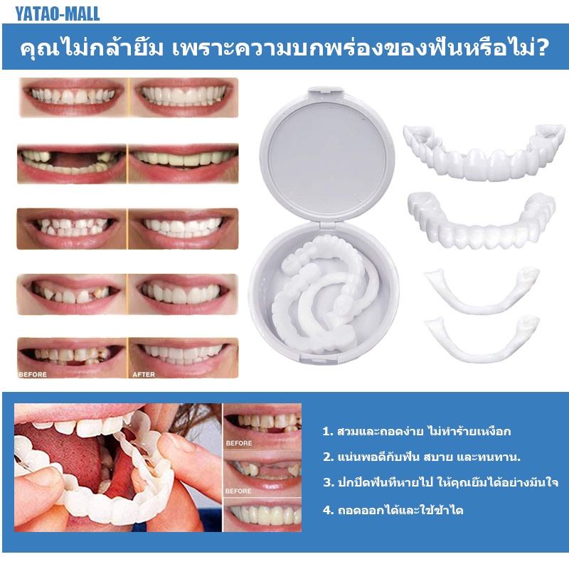 tooth-ฟันปลอม-ฟันปลอมแบบสวม-ฟันปลอมถอดทำความสะอาดได้-ฟันปลอมฟันปลอมหน้าบน-ฟันปลอมซี่หน้า-ฟันปลอม