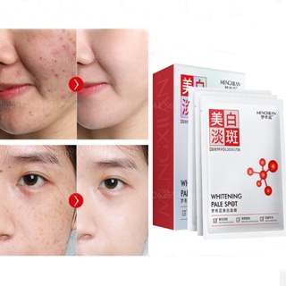10Pcs Nicotinamide Acid Whitening Freckle Mask Moisturizing Nourishing Oil Control Shrinking Pores Brighten Lighten Spot