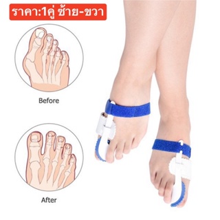 📌เฝือกจัดแม่เท้า1คู่📌 เฝือกอ่อน ดัด หรือจัด แม่โป้งเท้า ป้องกันอาการนิ้วซ้อน เอียง หรือเท้าเก กระดูกผิดรูป