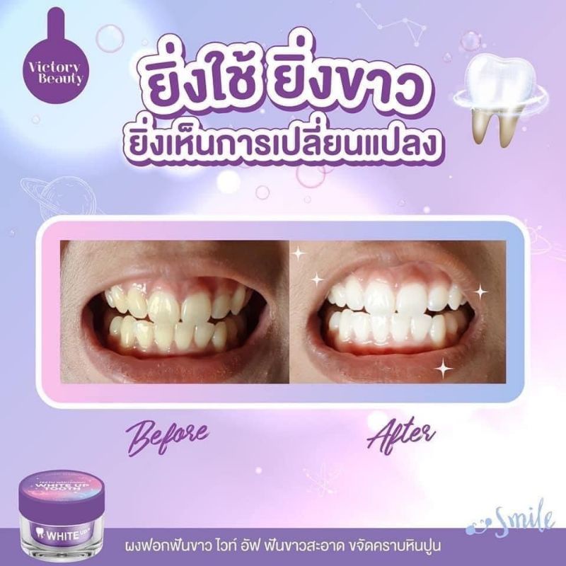 ผงฟอกฟันขาว-สูตรอเมริกา-victory-beauty-ผงฟอกฟันไวท์อัพ-white-up-tooth-teeth-whitening-ลดกลิ่นคราบเหลือง