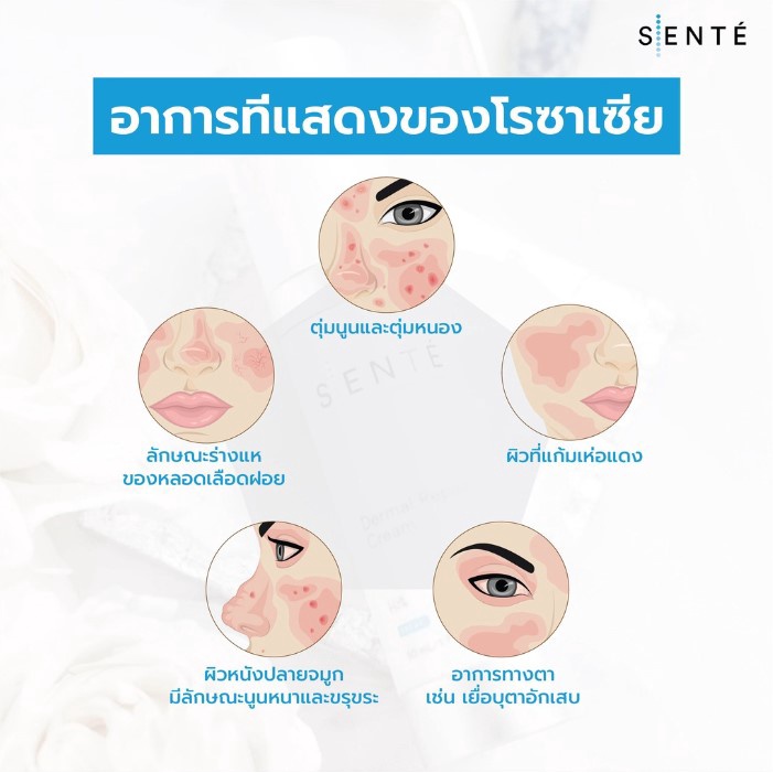 แท้100-sente-dermal-repair-cream-dermal-repair-ultra-nourish-ฟื้นบำรุงผิวที่แห้ง-แดง-ดูแลผิวหน้าหลังเลเซอร์