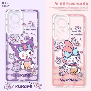 เคสโทรศัพท์มือถือแบบนิ่ม ใส ลายดวงตานางฟ้า เมโลดี้ สําหรับ case Xiaomi 11T 12 Lite POCO M5 F5 M4 M3 F4 X3 NFC F3 Redmi 13T 11A 12C 10C 10A 4A 5 Plus 5A 6A 7A 8 9A 9C 9T Note 12 5 7 8 9 9S 10 10S 11S 11 Pro