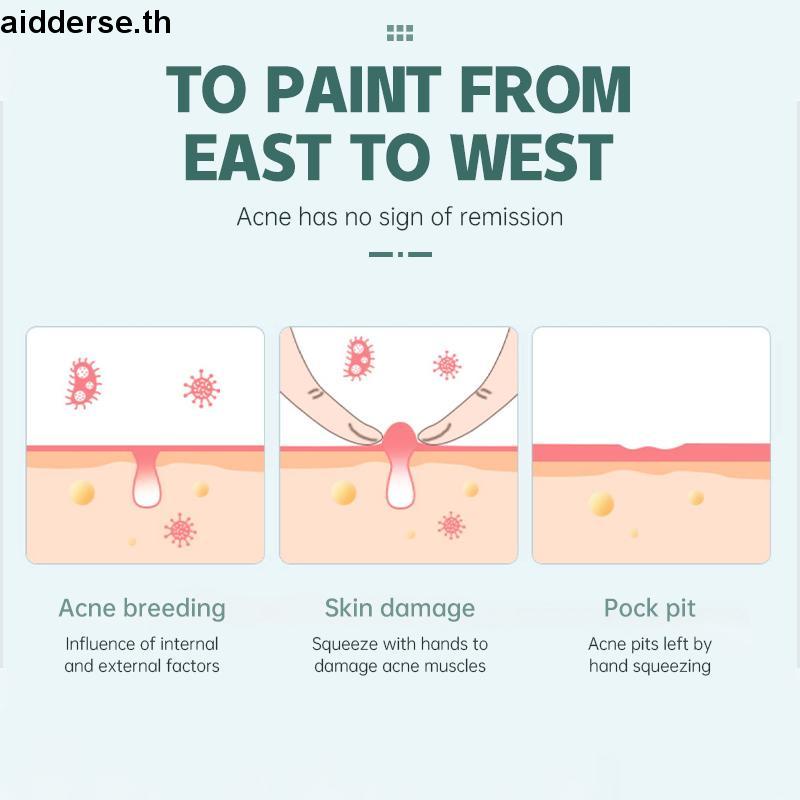 ภาพสินค้า36 ชิ้น แผ่นสติกเกอร์แปะสิว ดูดซับ Pus และน้ํามัน กําจัดสิว จากร้าน aidderse.th บน Shopee ภาพที่ 2