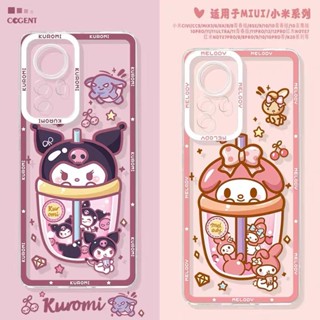 เคสโทรศัพท์มือถือแบบนิ่ม ใส ลายเมโลดี้ ตานางฟ้า น่ารัก สําหรับ case samsung Galaxy A05 A05S A21S A03 A72 A20S A03S A02S A71 A11 A02 A20 A30 A32 A13 A12 A30S A50 A50S A7 2018 A10S A04 A04S A52 A52S A31 A53 A51 M11 M12 M02 A23